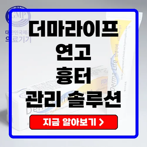 더마라이프 흉터연고 - 흉터 관리의 효과적인 동반자
